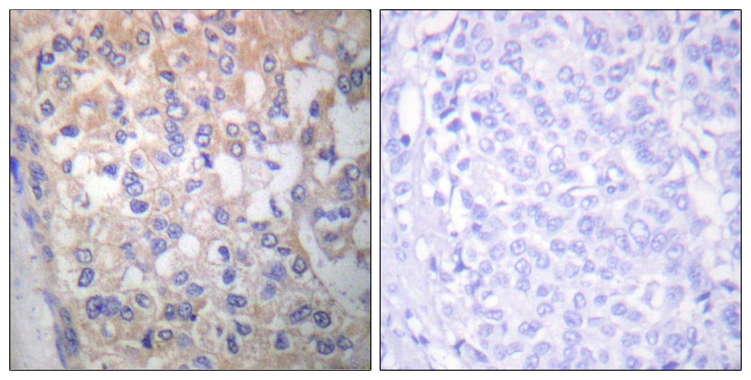 Polyclonal Rabbit anti-Human SYN / FYN Antibody (phospho-Tyr530, IHC, WB)