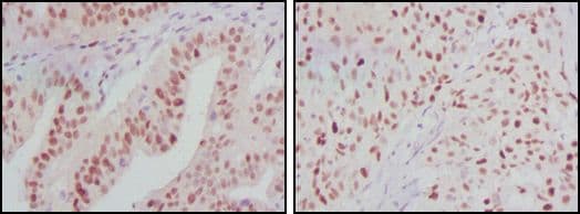 ATP2C1 Antibody (clone 4G12)