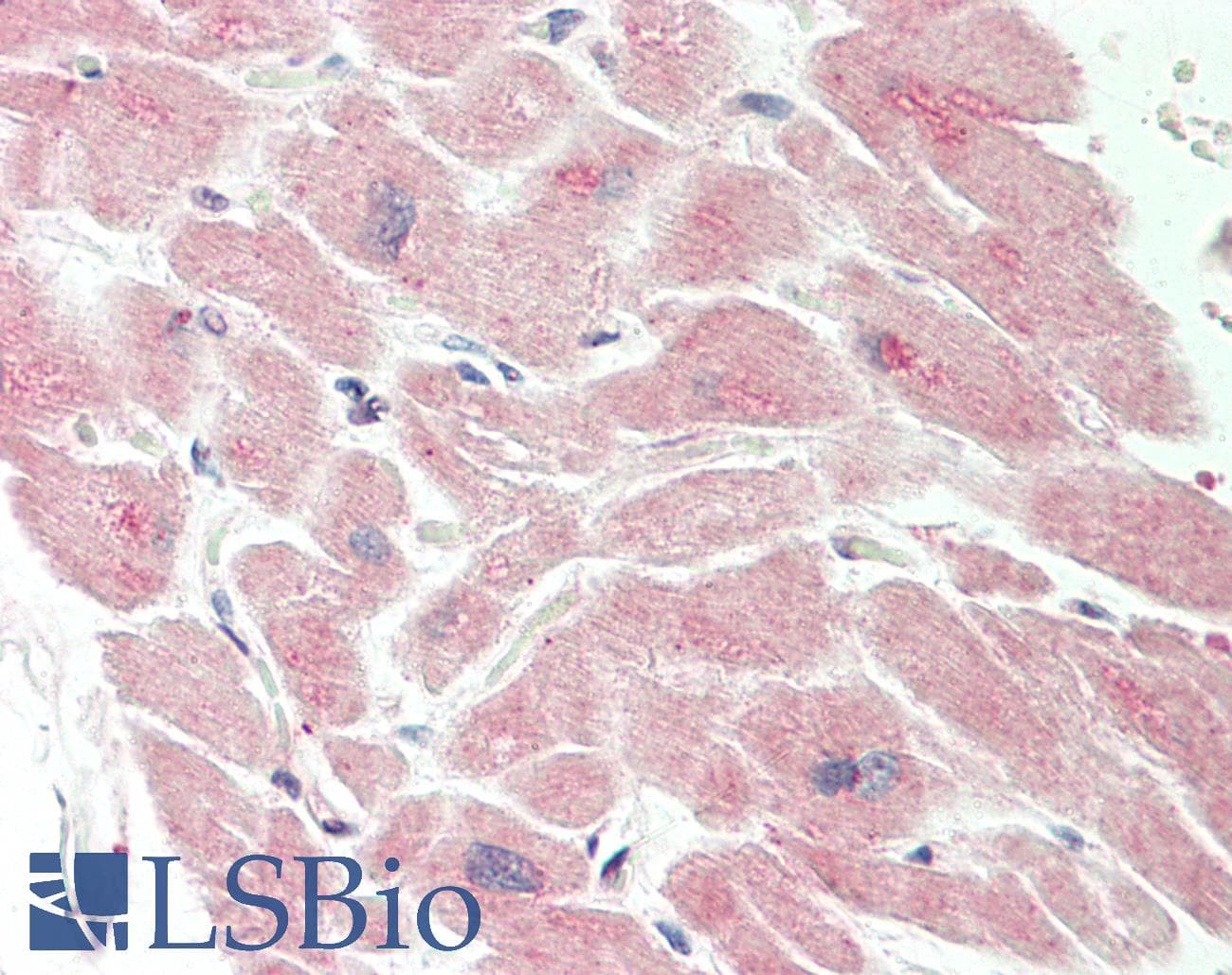 Polyclonal Rabbit anti-Human ACTRIIB / ACVR2B Antibody (aa323-372, IHC, WB)