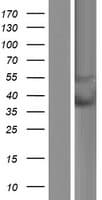IFIX / PYHIN1 Protein (Over-Expression Lysate Myc-DDK (Flag))