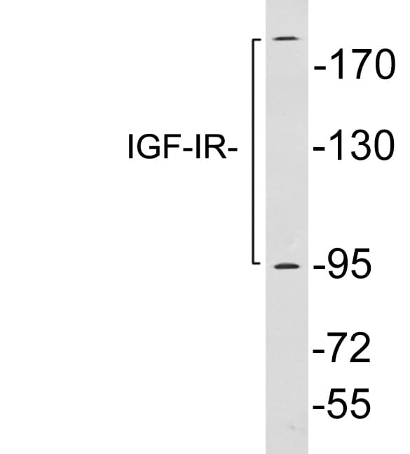 IGF1R / IGF1 Receptor Antibody (aa931-980)