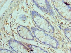 Polyclonal Rabbit anti-Human GOLM1 / GP73 / GOLPH2 Antibody (aa112-401, IHC)