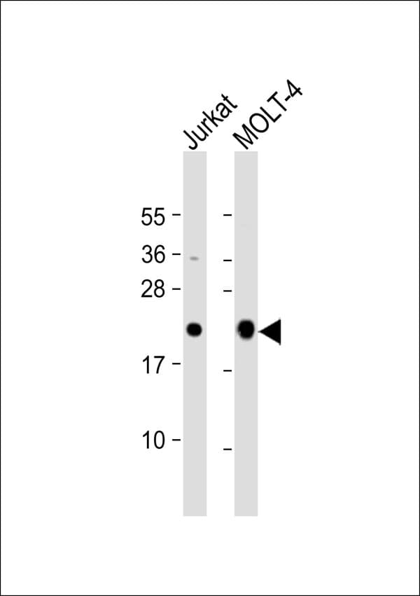 Polyclonal Rabbit anti-Human CD3E Antibody (WB)