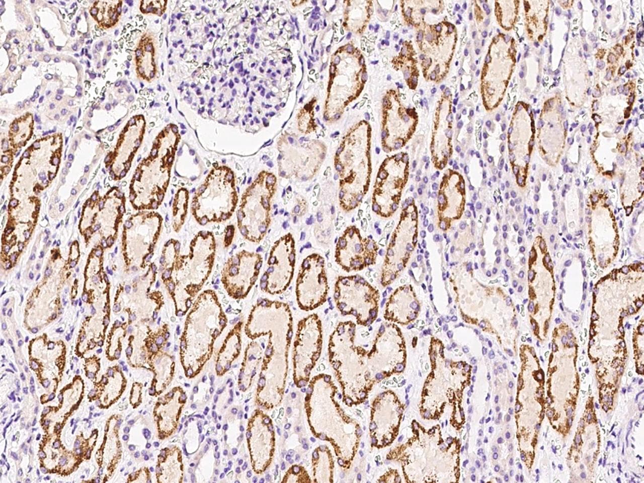 Polyclonal Rabbit anti-Human AIF1L Antibody (IHC)