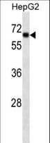 Monoclonal Mouse anti-Human SOX9 Antibody (aa41-70, WB)
