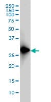 FRG1 Antibody (clone 4A5)