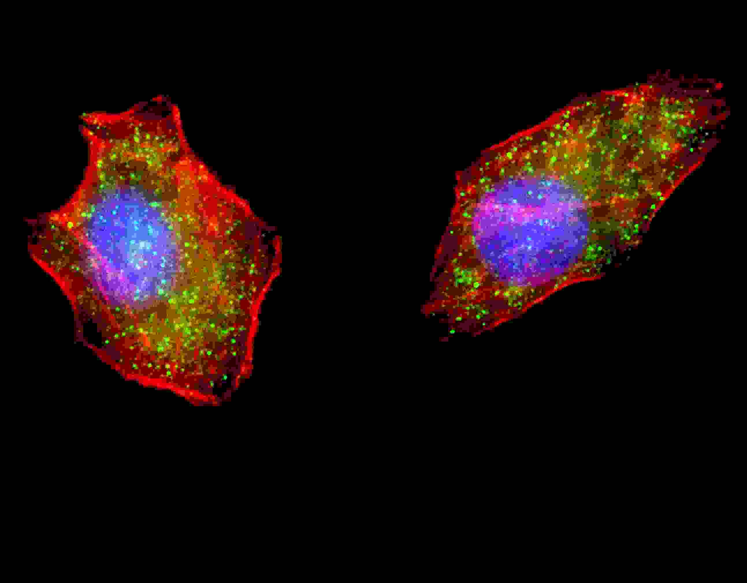 Polyclonal Rabbit anti-Human ATG4D Antibody (aa42-71, IHC, IF, WB)