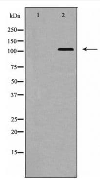 Polyclonal Rabbit anti-Human EPHA5 / EPH Receptor A5 Antibody (WB)