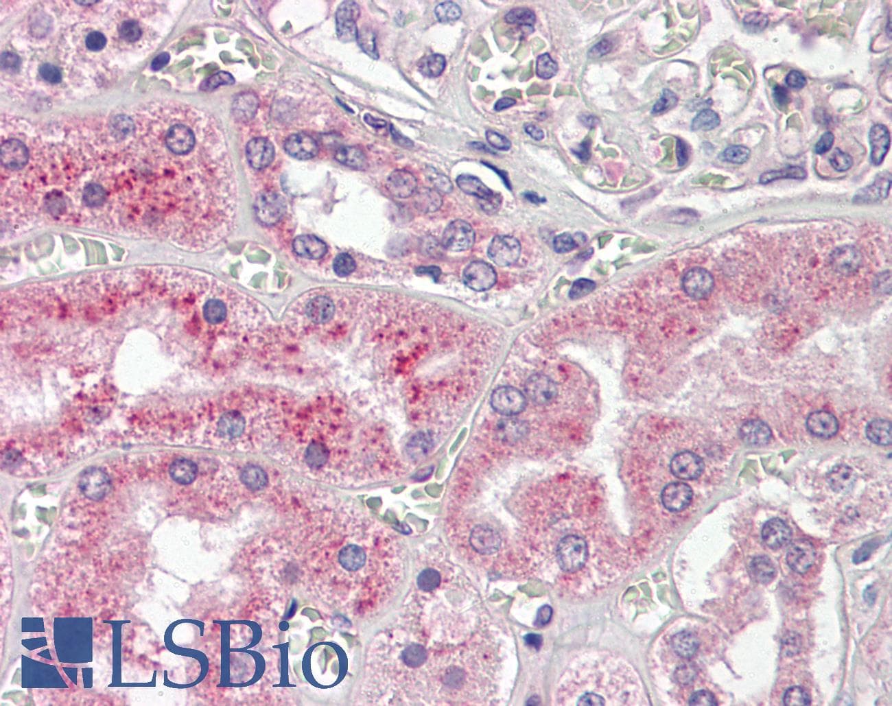 IHC-plus™ CTSL / Cathepsin L Antibody