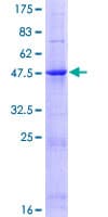 Human TIMP4 Protein (Recombinant GST)