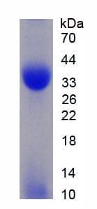 Rat CSPG4 / NG2 Protein (Recombinant His)