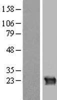 CRYGB Protein (Over-Expression Lysate Myc-DDK (Flag))