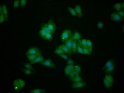 Polyclonal Rabbit anti-Human IL1RAPL1 Antibody (IHC, IF, WB)