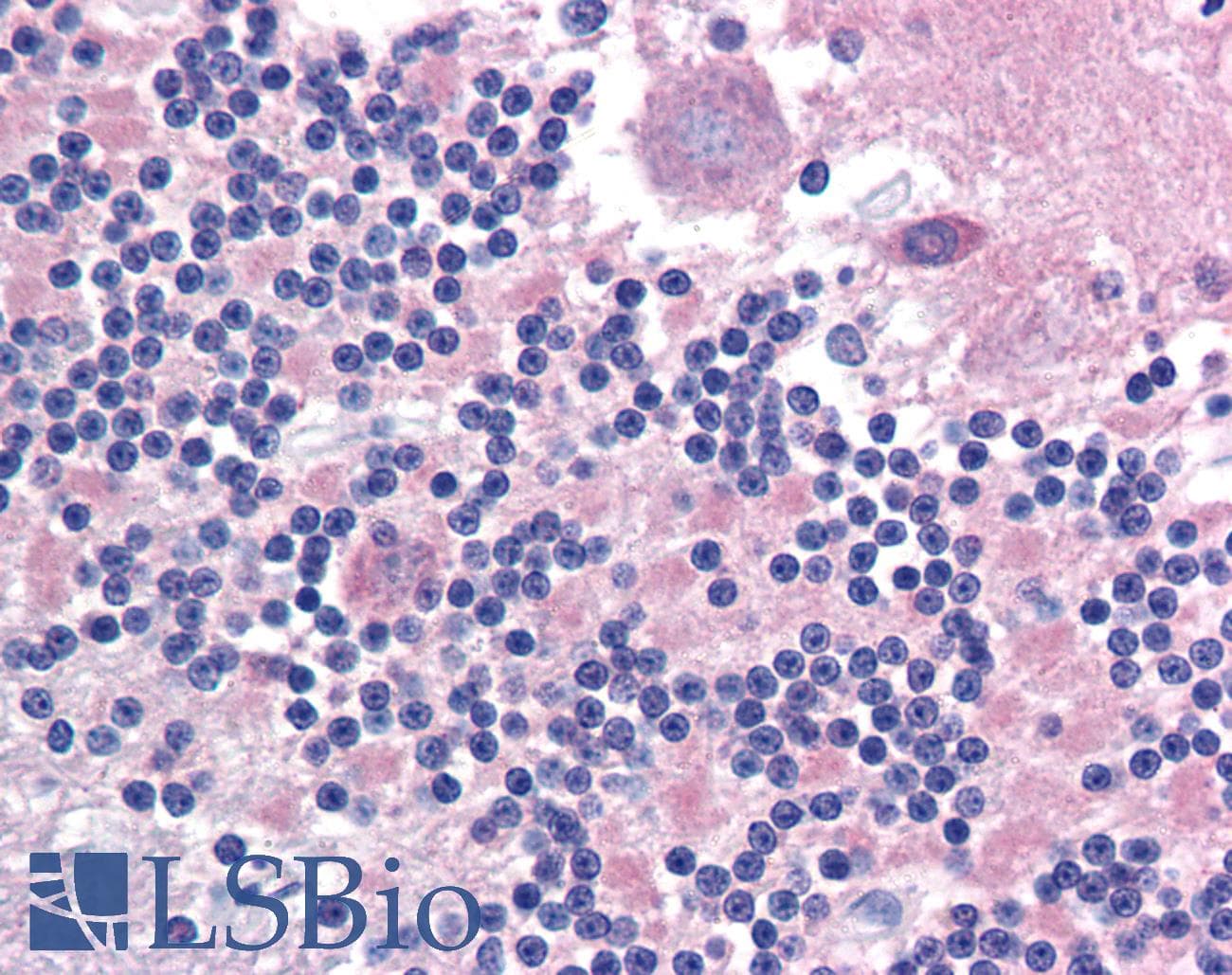 IHC-plus™ CADM2 Antibody (Internal)