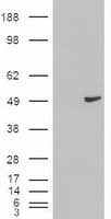 KRT18 / CK18 / Cytokeratin 18 Antibody (clone OTI5E8)