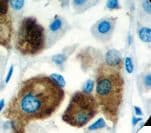ACTH Antibody (Ready-to-Use)