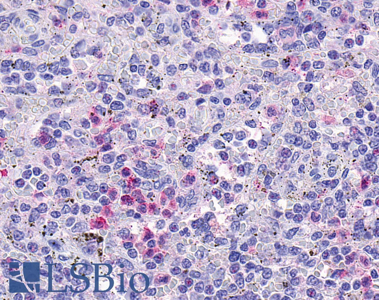 IHC-plus™ HCAR3 / GPR109B / HM74 Antibody (C-Terminus)