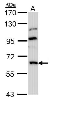 GNT-III / MGAT3 Antibody (aa260-525)