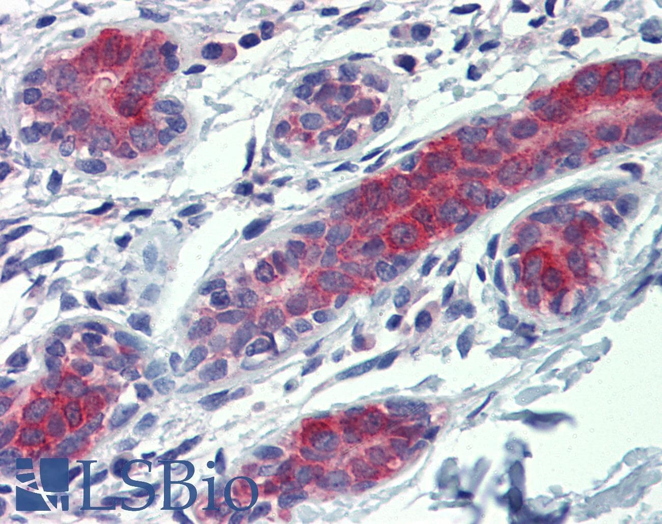 IHC-plus™ YES1 / c-Yes Antibody