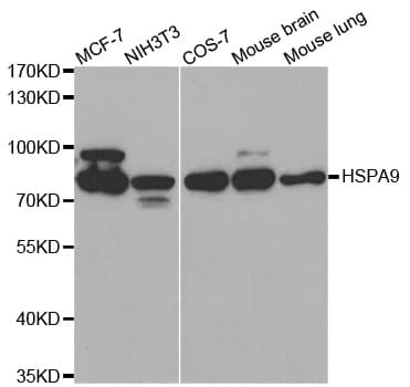 Polyclonal Rabbit anti-Human HSPA9 / Mortalin / GRP75 Antibody (IHC, IF, WB)