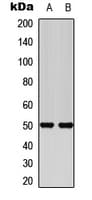 SCTR / SR / Secretin Receptor Antibody (Internal)