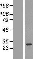 Human GSTM2 Protein (Over-Expression Lysate Myc-DDK (Flag))