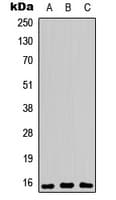 PEA15 / PEA-15 Antibody (phospho-Ser104)