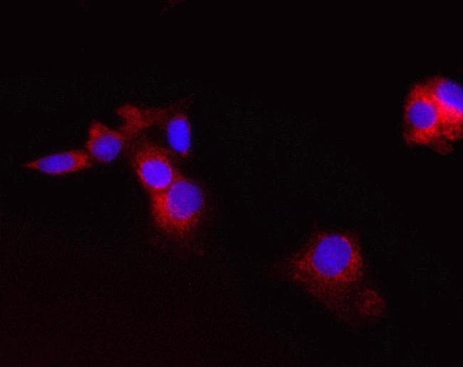 Monoclonal Mouse anti-Human CPT2 Antibody (clone 1C2AE6, IF)