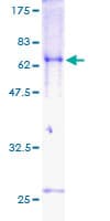 Human TOB2 Protein (Recombinant GST)