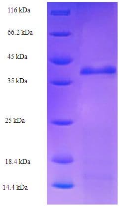 E. coli ruvA Protein (Recombinant His-SUMO)