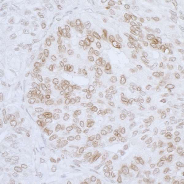 TMPO / TP / Thymopoietin Antibody (aa300-350)