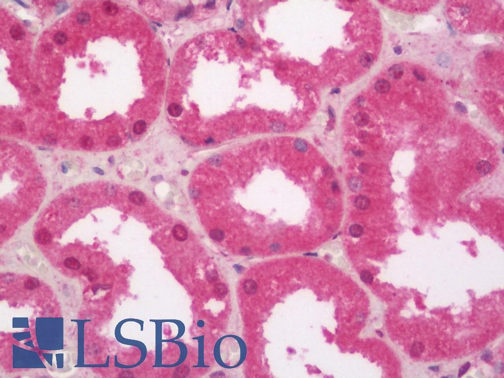 IHC-plus™ Polyclonal Rabbit anti-Human SLC29A1 / ENT1 Antibody (IHC, IF, WB)