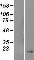 CAV1 / Caveolin 1 Protein (Over-Expression Lysate Myc-DDK (Flag))