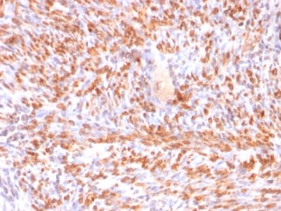 CNN1 / Calponin Antibody (clone rCNN1/832, Azide-free, Carrier-free)