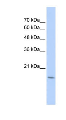 CDC42EP5 Antibody (aa35-84)