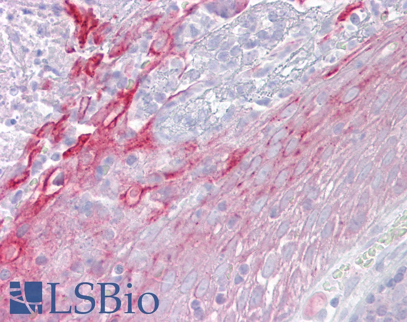 Properdin / CFP Antibody (aa35-84)