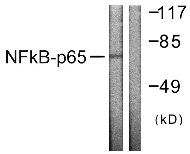 RELA / NFKB p65 Antibody (aa471-520)