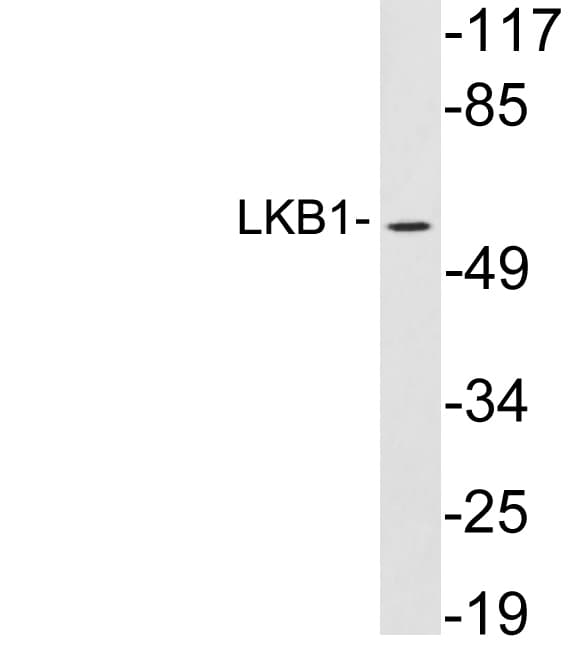 STK11 / LKB1 Antibody (aa140-189)