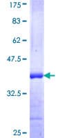 Human Mitofusin 2 / MFN2 Protein (Recombinant GST, N-terminus)