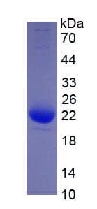 Human IL-1B / IL-1 Beta Protein (Recombinant His, N-Terminal)