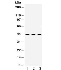 Polyclonal Rabbit anti-Human AMACR / P504S Antibody (WB)