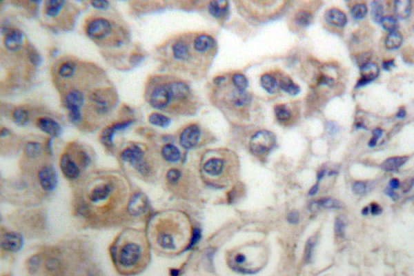 PLCB3 Antibody (Leu532)