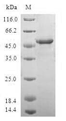 Human CCN5 Protein (Recombinant GST, N-terminus)