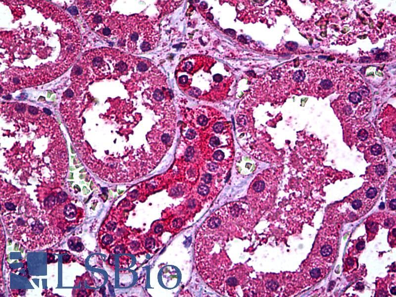 IHC-plus™ ERBB3 / HER3 Antibody (clone 2E9)