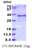 Human Endothelin 3 / EDN3 Protein (Recombinant His)