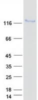 Human CAST / Calpastatin Protein (Recombinant Myc-DDK (Flag))