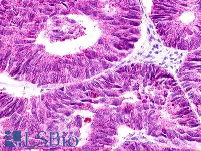PathPlus™ GPR12 Antibody (C-Terminus)