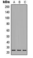 ORM1 / Orosomucoid Antibody (Internal)