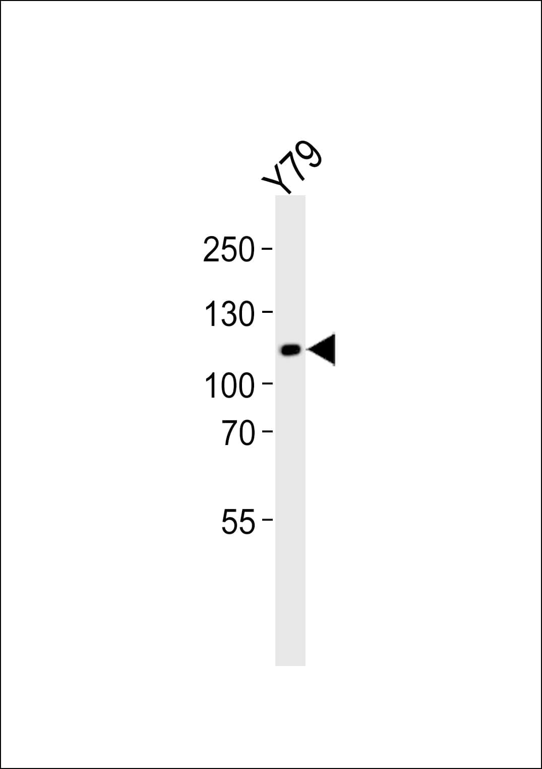 ANKRD24 Antibody (aa296-328)