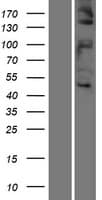 Human c-Met Protein (Over-Expression Lysate Myc-DDK (Flag))